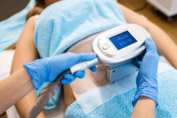 Cryolipolysis Treatment Malaysia: Non-Surgical Fat Reduction That Works